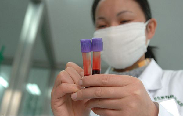 池州揭秘：DNA亲子鉴定全过程 